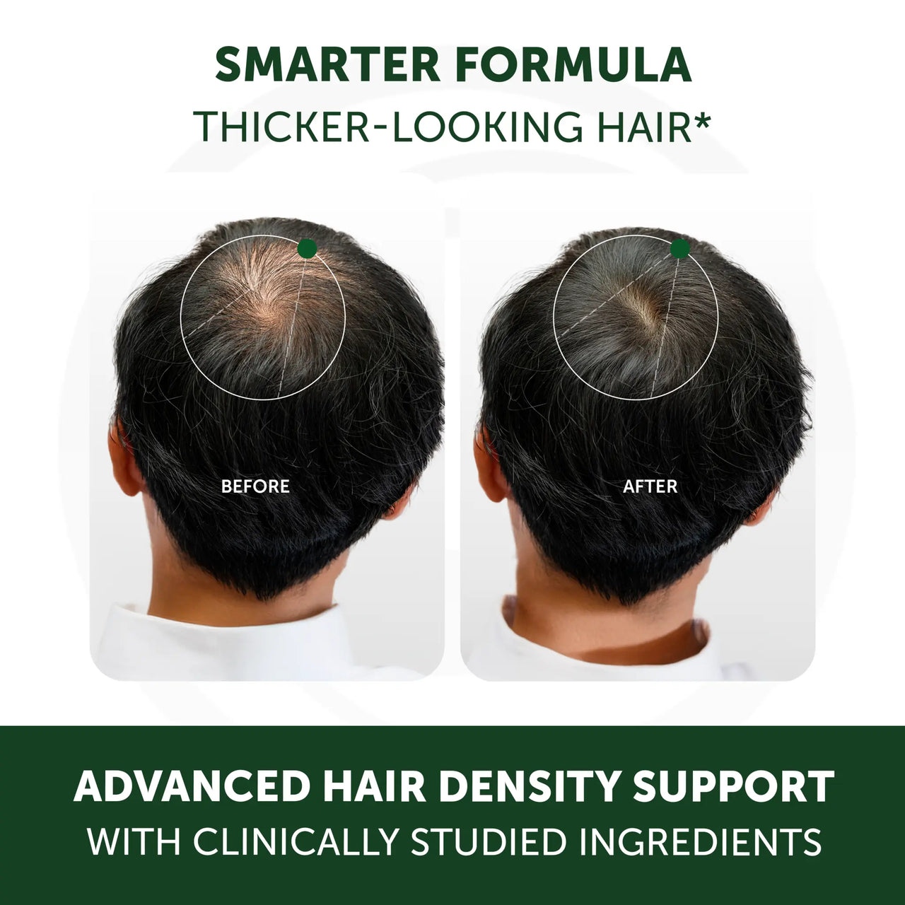 Lunakai PRO Men’s Hair Growth & Restore - 90 Capsules