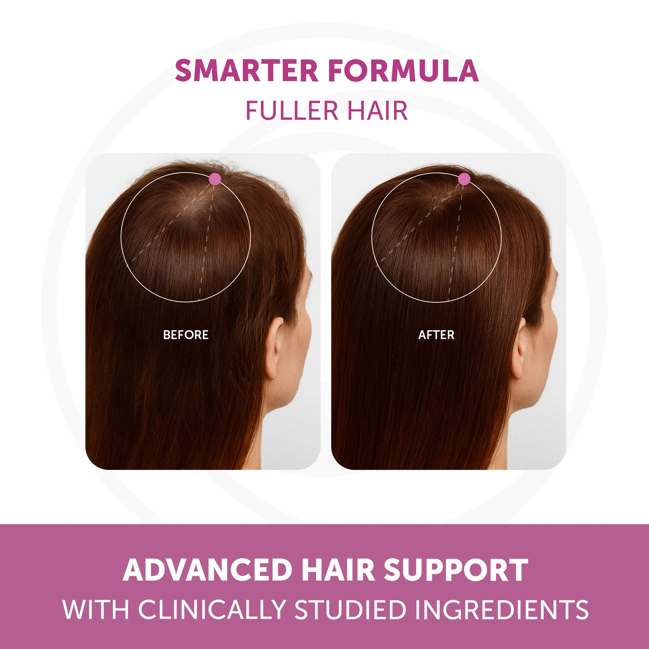 Lunakai PRO Women’s Growth & Restore Vitamins – Hair, Skin, & Hormonal Support
